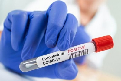 AIIMS के तीन प्रोफेसर सहित कोरोना के 201 केस, देहरादून जिले में सबसे ज्यादा पॉजिटिव