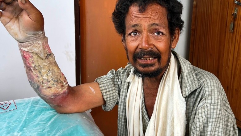 राजू को मिला नया जीवन; अब है स्वस्थ; डीएम स्वयं कर रहे थे मॉनीटरिंग