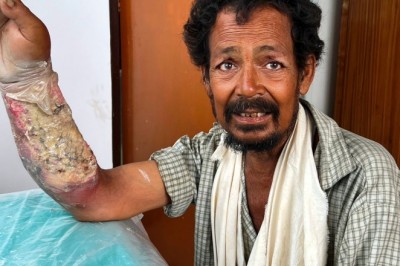 राजू  को  मिला  नया  जीवन; अब है स्वस्थ; डीएम स्वयं कर रहे थे मॉनीटरिंग